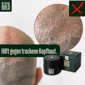 NO HAIR. FULL CARE. BALD CREAM. Glatzenpflege BetterBeBold