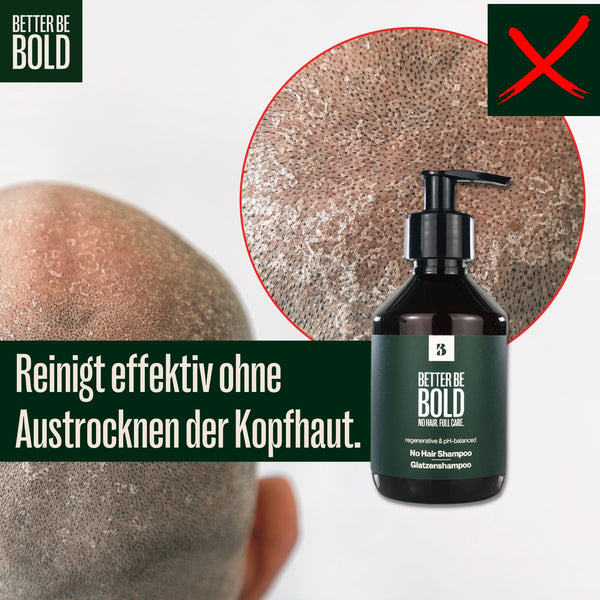 Glatzenshampoo | No Hair Shampoo Glatzenpflege BetterBeBold   
