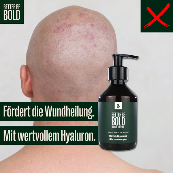 Glatzenshampoo | No Hair Shampoo Glatzenpflege BetterBeBold   