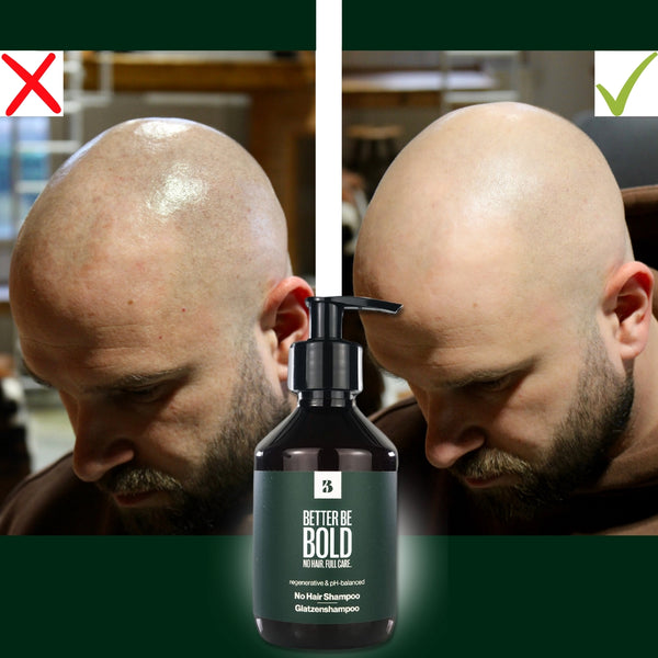 Glatzenshampoo | No Hair Shampoo Glatzenpflege BetterBeBold   